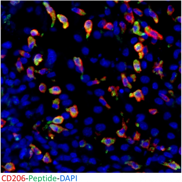 Long persistence of an M2 TAM internalizing peptide in breast tumors