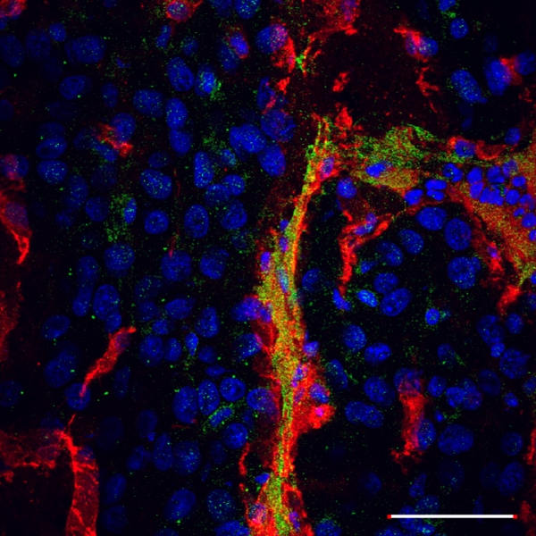 Linear TT1 peptide-coupled FAM-labeled iron oxide nanoparticles home to blood vessels of subcutaneous U87 tumor xenograft