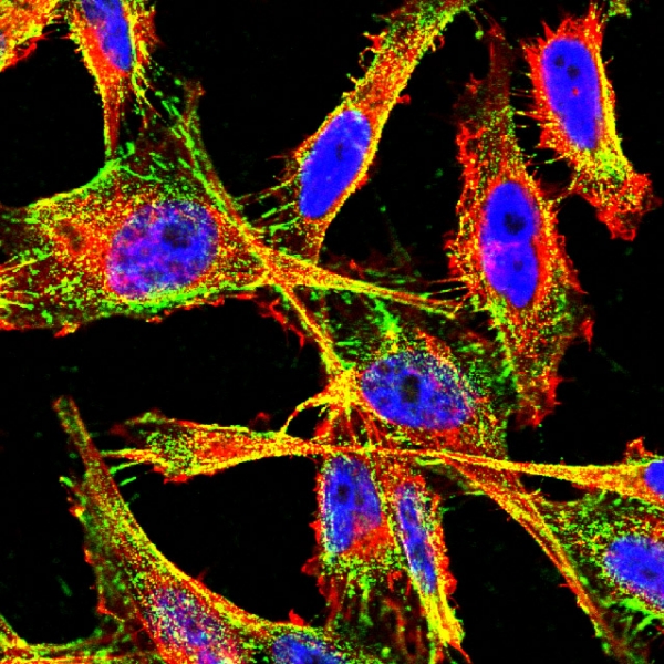Internalization of prototypic CendR (RPARPAR) phage by PPC1 prostate carcinoma cells in culture