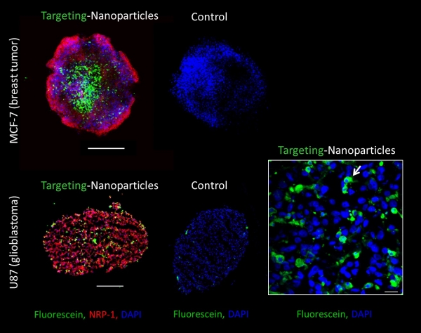 Targeting-polymeric nanoparticles are internalized in MCF-7 and U87 spheroids